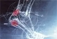 tendinite du tendon d'achile et ondes de choc